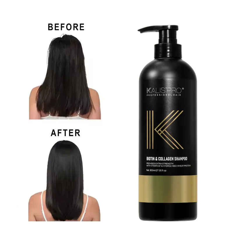 Factory Custom Biotin & Collagen Anti-Dandruff Shampoo – Moisturizing Salon & Home Hair Care