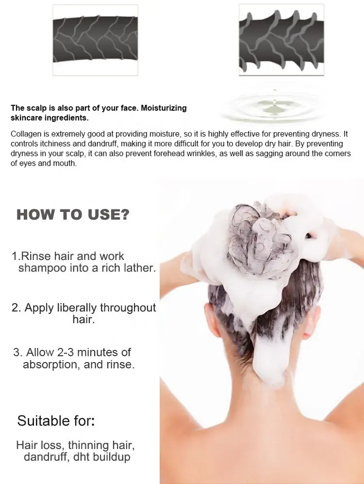Factory Custom Biotin & Collagen Anti-Dandruff Shampoo – Moisturizing Salon & Home Hair Care - Image 2
