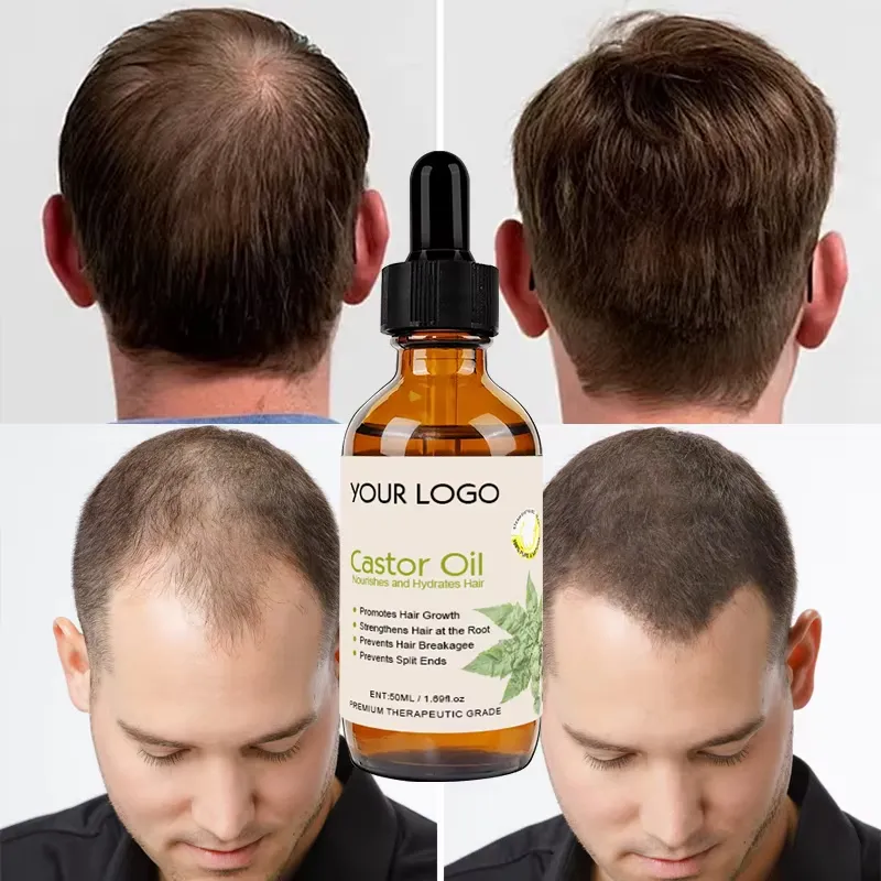 Private Label Peppermint Keratin Collagen Hair Regrowth Oil – Argan & Tea Tree Scalp Treatment - Image 3